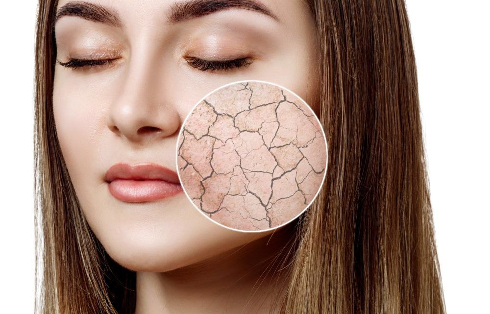 dryskin