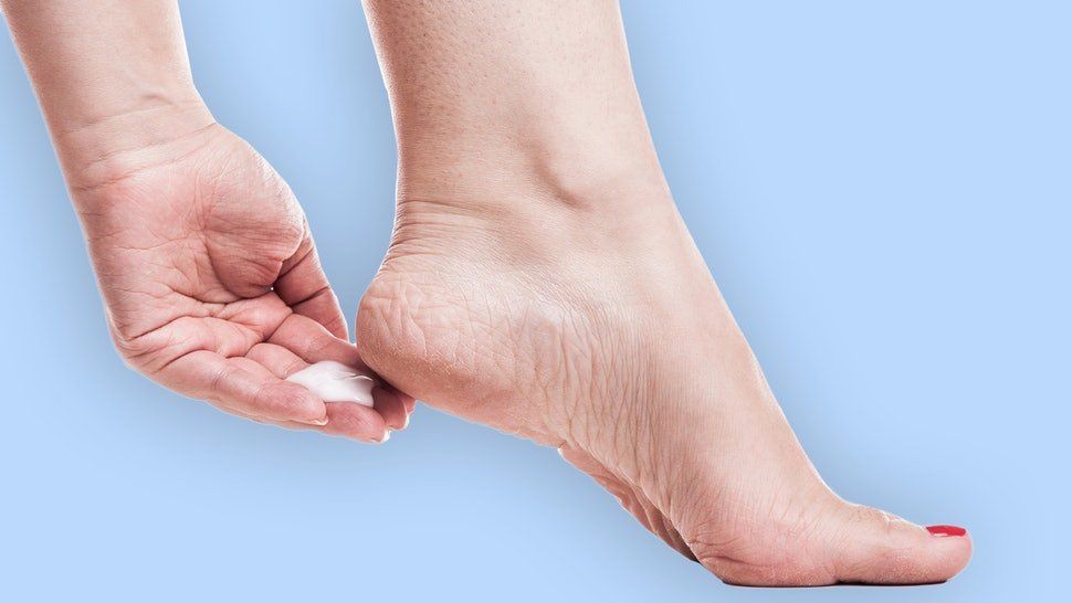 Dry Heels: Causes, Treatments & More | Canyon Oaks Fresno Podiatrist