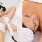 Underarms Laser Hair Removal